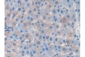 DAB staining on IHC-P; Samples: Rat Liver Tissue (RANKL antibody  (AA 106-240))