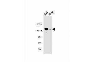 All lanes : Anti-UBE4B Antibody (N-term) at 1:1000 dilution Lane 1: Raji whole cell lysate Lane 2: Hela whole cell lysate Lysates/proteins at 20 μg per lane.