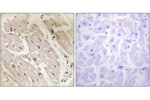 Immunohistochemistry (IHC) image for anti-Protein Kinase, AMP-Activated, gamma 2 Non-Catalytic Subunit (PRKAG2) (AA 1-50) antibody (ABIN1534170)
