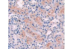Used in DAB staining on fromalin fixed paraffin- embedded Kidney tissue (Ancient Ubiquitous Protein 1 antibody  (AA 201-410))