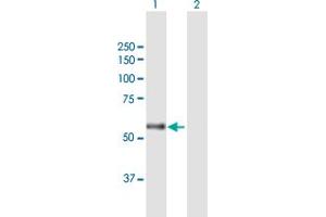 Western Blot analysis of CARD14 expression in transfected 293T cell line by CARD14 MaxPab polyclonal antibody. (CARD14 antibody  (AA 1-434))