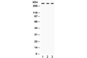 Western blot testing of human 1) HepG2, 2) U87 and 3) Raji cell lysate with FASN antibody.