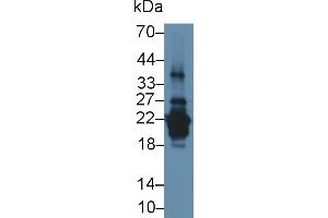 Detection of PRH2 in Human Saliva using Polyclonal Antibody to Acidic Salivary Proline Rich Phosphoprotein 2 (PRH2) (PRH2 antibody  (AA 17-166))