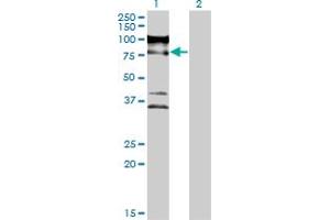 Western Blot analysis of ZNF274 expression in transfected 293T cell line by ZNF274 monoclonal antibody (M04), clone 1D8. (ZNF274 antibody  (AA 420-530))