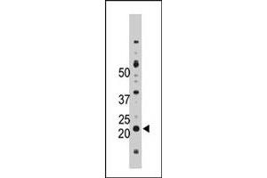 The NME4 polyclonal antibody  is used in Western blot to detect NME4 in Jurkat cell lysate. (NME4 antibody  (C-Term))