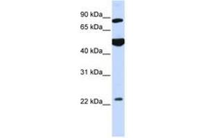 Image no. 1 for anti-Mannosyl-Oligosaccharide Glucosidase (MOGS) (AA 144-193) antibody (ABIN6740983) (GCS1 antibody  (AA 144-193))
