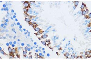 Immunohistochemistry of paraffin-embedded Mouse testis using IGF2BP3 Polyclonal Antibody at dilution of 1:100 (40x lens). (IGF2BP3 antibody)