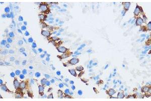 Immunohistochemistry of paraffin-embedded Mouse testis using IGF2BP3 Polyclonal Antibody at dilution of 1:100 (40x lens).