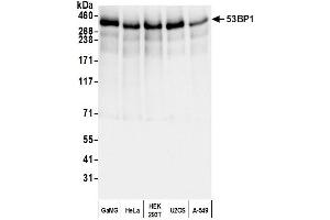 Western Blotting (WB) image for anti-Tumor Protein P53 Binding Protein 1 (TP53BP1) (AA 350-400) antibody (ABIN7453568) (TP53BP1 antibody  (AA 350-400))