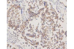 IHC analysis of EGFR using anti-EGFR antibody (ABIN5518909). (EGFR antibody  (N-Term))
