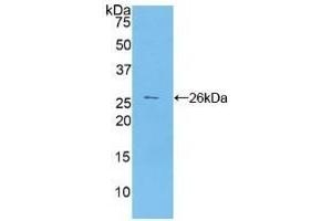 Detection of Recombinant CA125, Human using Polyclonal Antibody to Carbohydrate Antigen 125 (CA125)
