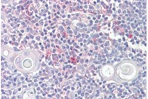 Anti-LITAF antibody IHC staining of human thymus. (LITAF antibody  (AA 51-64))