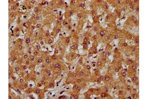 IHC image of ABIN7149663 diluted at 1:200 and staining in paraffin-embedded human liver tissue performed on a Leica BondTM system. (Transmembrane 7 Superfamily Member 4 (TM7SF4) (AA 119-209) antibody)