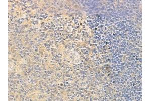ABIN6257955 and ABIN6273780 at 1/100 staining human normal tonsil tissue by IHC-P. (BAG2 antibody  (C-Term))