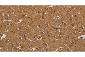 Immunohistochemistry of paraffin-embedded Human brain using HSD17B2 Polyclonal Antibody at dilution of 1:50 (HSD17B2 antibody)