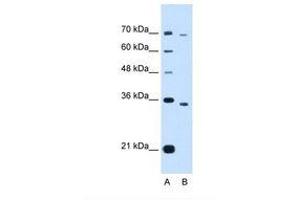 Image no. 1 for anti-PHD Finger Protein 6 (PHF6) (AA 152-201) antibody (ABIN321840) (PHF6 antibody  (AA 152-201))
