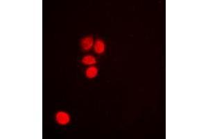 Immunofluorescence (IF) image for anti-Tumor Protein P53 (TP53) (C-Term) antibody (ABIN7301404)