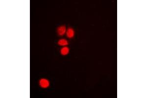 Immunofluorescent analysis of p53 staining in HeLa cells.