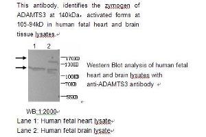 Image no. 1 for anti-ADAM Metallopeptidase with Thrombospondin Type 1 Motif, 3 (ADAMTS3) antibody (ABIN790775)