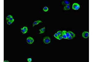 Immunofluorescent analysis of MCF-7 cells using ABIN7153609 at dilution of 1:100 and Alexa Fluor 488-congugated AffiniPure Goat Anti-Rabbit IgG(H+L) (GJB2 antibody  (AA 99-131))