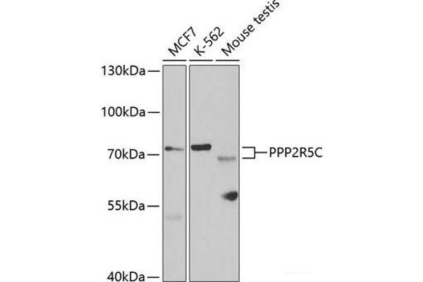 PPP2R5C antibody