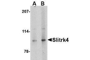 Image no. 1 for anti-SLIT and NTRK-Like Family, Member 4 (SLITRK4) (C-Term) antibody (ABIN1492201) (SLITRK4 antibody  (C-Term))