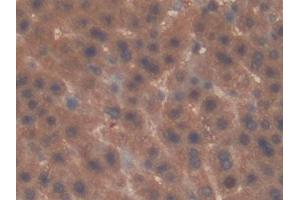 Immunohistochemistry (IHC) image for anti-Interleukin 22 Receptor, alpha 2 (IL22RA2) (AA 30-228) antibody (ABIN7435865)