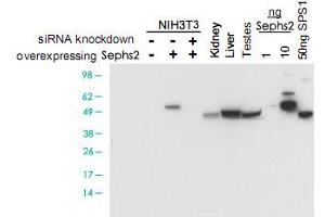 Western blot using Sephs2 polyclonal antibody  shows detection of Sephs2 in NIH/3T3 cells over-expressing this protein. (SEPHS2 antibody)