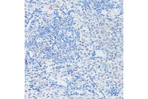 Immunohistochemistry of paraffin-embedded rat spleen using CASP3 antibody. (Caspase 3 antibody  (AA 55-160))