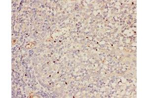 IHC-P: FOXP3 antibody testing of human tonsil tissue (FOXP3 antibody  (AA 101-431))