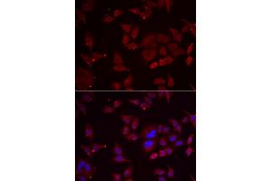 Immunofluorescence analysis of U2OS cells using PFKFB3 antibody (ABIN5974173). (PFKFB3 antibody)