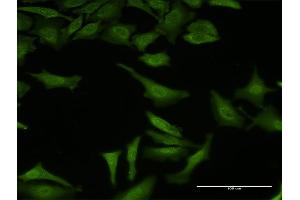 Immunofluorescence of monoclonal antibody to SF3B3 on HeLa cell. (SF3B3 antibody  (AA 819-929))