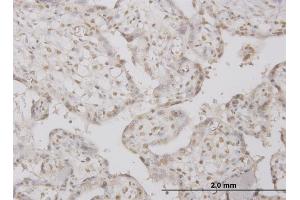 Immunostaining (ISt) image for anti-Protein Phosphatase 1, Regulatory (Inhibitor) Subunit 2 (PPP1R2) (AA 1-100) antibody (ABIN562349)