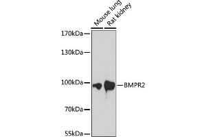 Western blot analysis of extracts of various cell lines, using BMPR2 antibody (ABIN7265906) at 1:1000 dilution. (BMPR2 antibody  (AA 27-150))