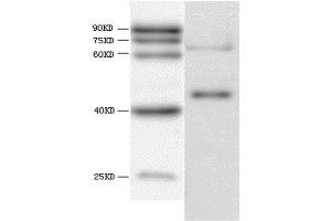 WB analysis of recombinant Hepatitis E virus ORF 3, using HEV ORF3 antibody. (HEV ORF3 antibody  (AA 34-123))