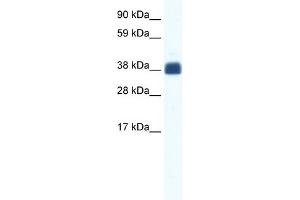 WB Suggested Anti-CX36 Antibody Titration:  1. (GJD2 antibody  (Middle Region))