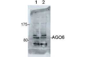 Western Blotting (WB) image for anti-Argonaute 6 (AGO6) antibody (ABIN619533) (AGO6 antibody)