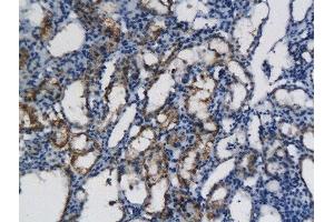 Formalin-fixed and paraffin embedded rat kidney labeled with Anti- CXCL11 Polyclonal Antibody, Unconjugated  followed by conjugation to the secondary antibody and DAB (CXCL11 antibody  (AA 22-100))