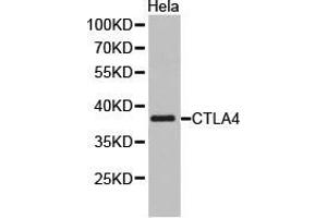 Western Blotting (WB) image for anti-Cytotoxic T-Lymphocyte-Associated Protein 4 (CTLA4) antibody (ABIN1872073) (CTLA4 antibody)