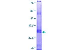 Keratin Associated Protein 4-4 (KRTAP4-4) (AA 1-166) protein (GST tag)