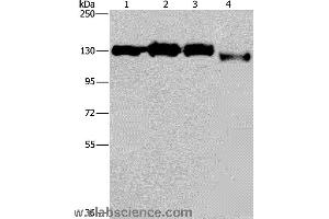 Western blot analysis of Hela, 293T, Raji and 231 cell, using GTF2I Polyclonal Antibody at dilution of 1:400 (GTF2I antibody)