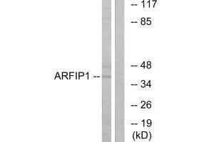 Western blot analysis of extracts from Jurkat cells, using ARFIP1 antibody. (ARFIP1 antibody)