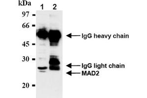 Western Blotting (WB) image for anti-MAD2 Mitotic Arrest Deficient-Like 1 (Yeast) (MAD2L1) antibody (ABIN567786) (MAD2L1 antibody)