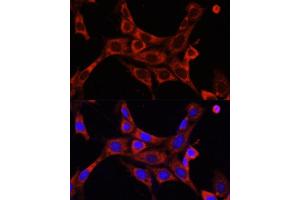 Immunofluorescence analysis of NIH/3T3 cells using IR antibody (ABIN6130497, ABIN6142514, ABIN6142515 and ABIN6216327) at dilution of 1:100. (IRAK1 antibody  (AA 424-633))