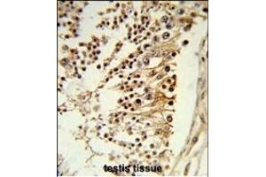Formalin-fixed and paraffin-embedded human testis tissue reacted with CENPH Antibody (Center), which was peroxidase-conjugated to the secondary antibody, followed by DAB staining. (CENPH antibody  (AA 136-162))