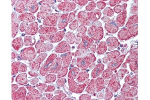 Anti-AKT antibody IHC of human heart. (AKT1/2 antibody)