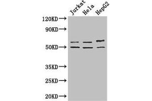 Western Blot Positive WB detected in: Jurkat whole cell lysate, Hela whole cell lysate, HepG2 whole cell lysate All lanes: YTHDF2 antibody at 2. (YTHDF2 antibody  (AA 201-500))