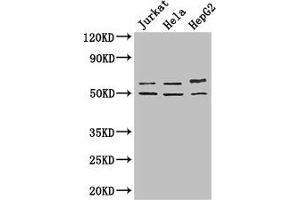 YTHDF2 antibody  (AA 201-500)