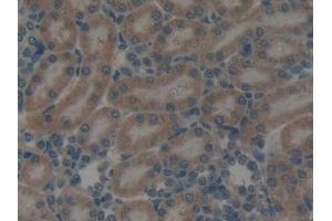 Immunohistochemistry (IHC) image for anti-GATA Binding Protein 4 (GATA4) (AA 228-440) antibody (ABIN7431686)