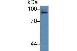 Detection of ICAM1 in Human dog liver cell lysate using Polyclonal Antibody to Intercellular Adhesion Molecule 1 (ICAM1) (ICAM1 antibody  (AA 25-531))
